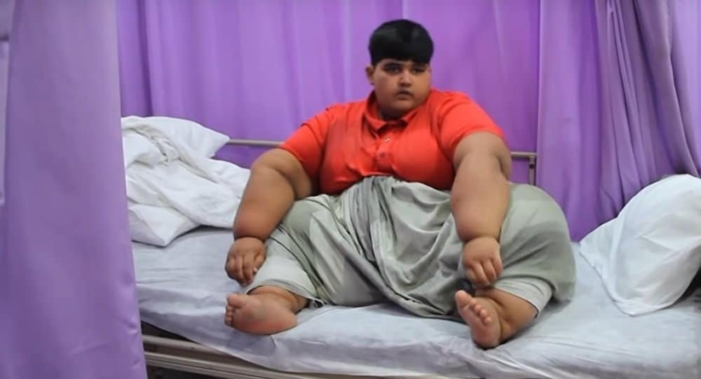 World's Heaviest Boy Weighs 196 Kg and Needs Life-Saving Operation