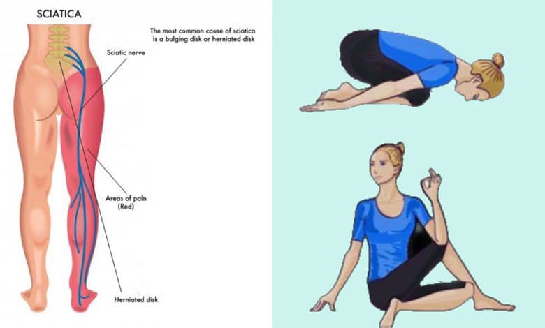 9 Yoga Poses for Sciatica Pain Relief